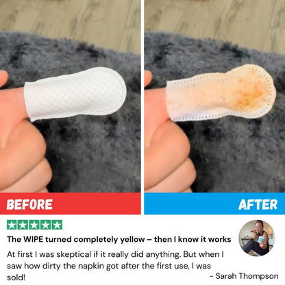 Pet Dental Finger Wipes